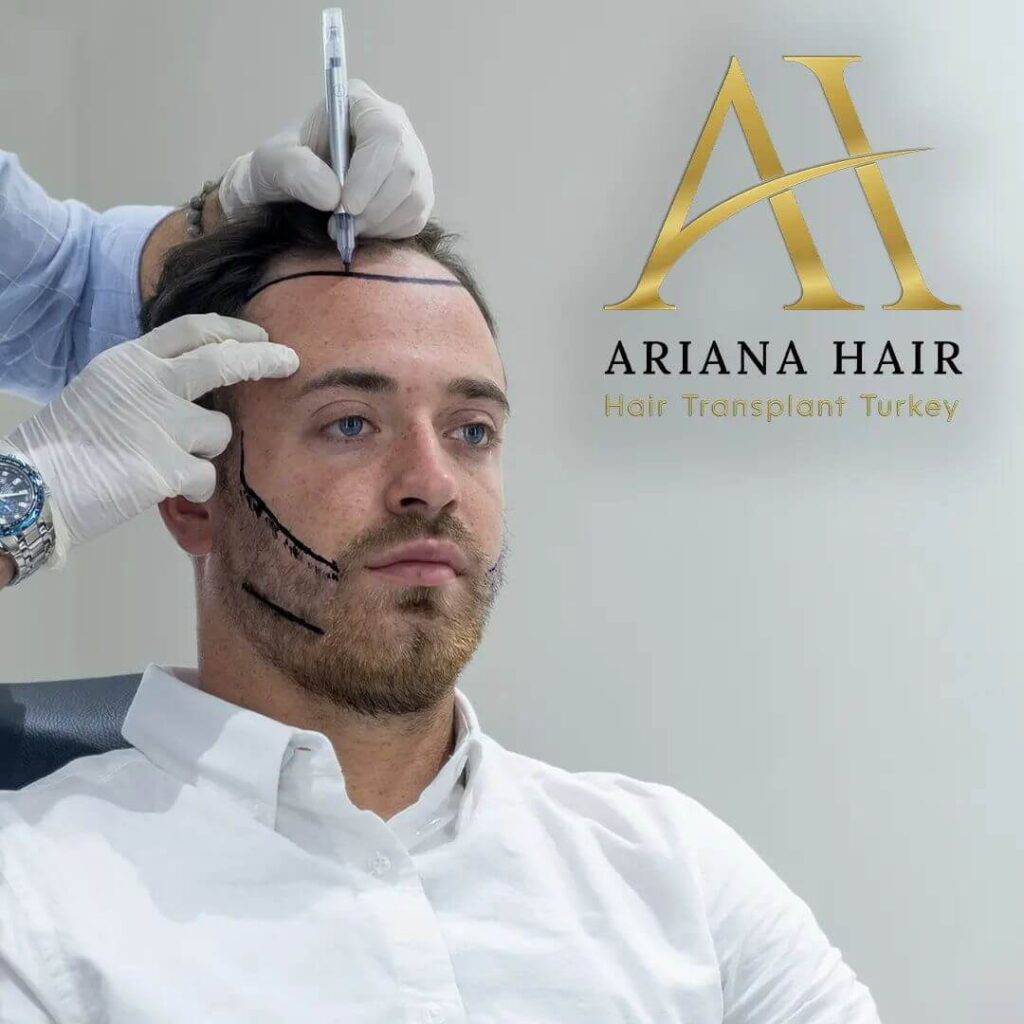 Hair Transplant in Turkey Ariana Hair Clinic